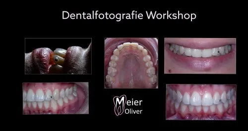 Dentalfotografie Blog für Zahnärzte & Zahntechniker  icon